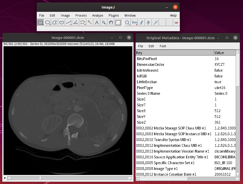 ImageJ 使用 Bio-Formats 套件匯入的 DICOM 影像