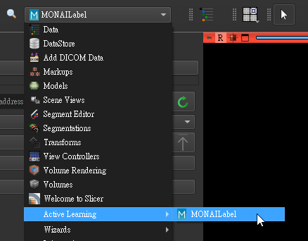 MONAI Label 按鈕