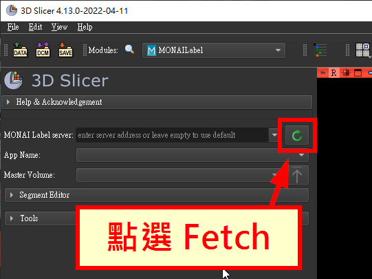點選 Fetch 按鈕