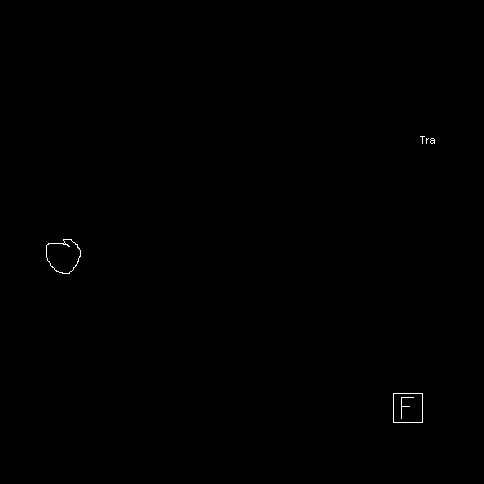 Overlay 影像