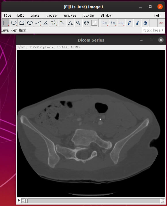 Fiji（ImageJ）